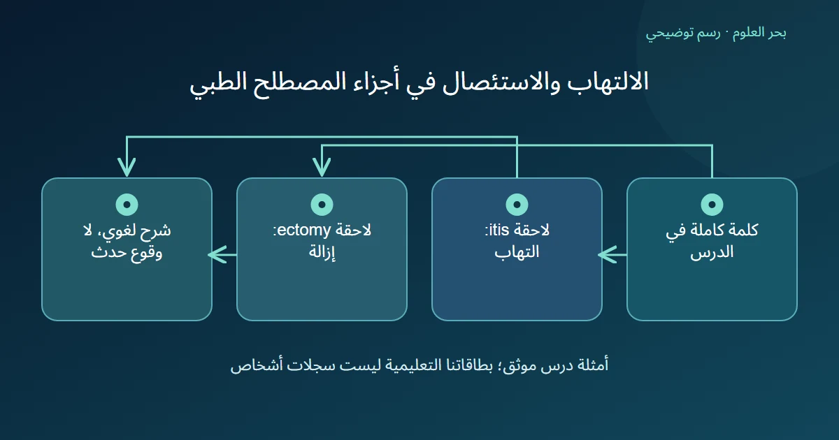 رسم توضيحي: كلمة كاملة في الدرس؛ لاحقة itis: التهاب؛ لاحقة ectomy: إزالة؛ شرح لغوي، لا وقوع حدث